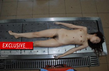 Dead Girl Autopsy Stark Naked on Morgue Table 
